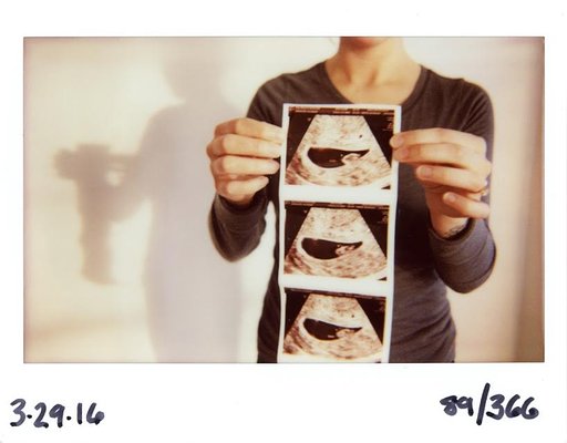 366 Days in an Instant: An Interview With Matt Day