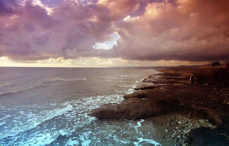 Photos by finasteride