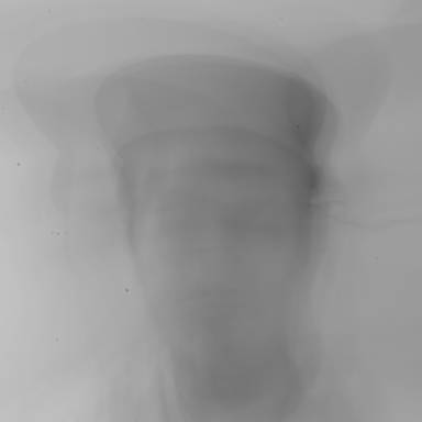 lomo_bernis